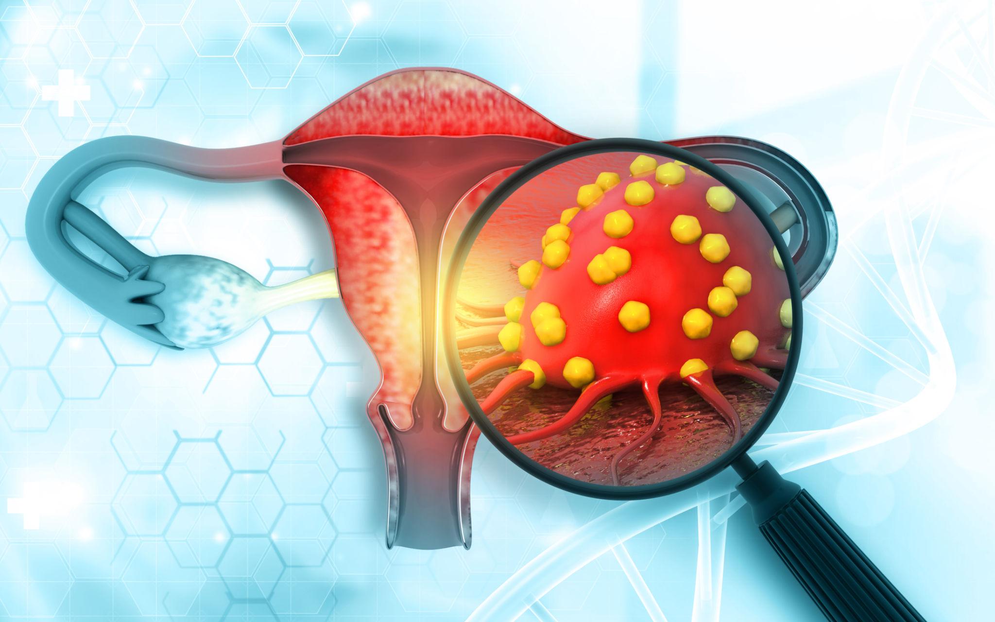 Gynec Cancer Robotic Surgeon in Pune – Advanced Cancer Care by Experts